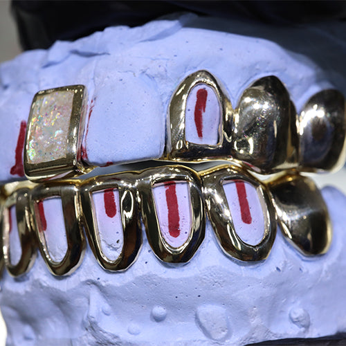 Mother of Pearl Grillz