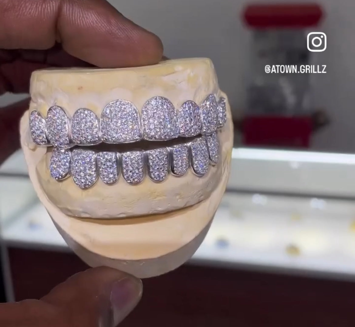 Moissinate Grillz